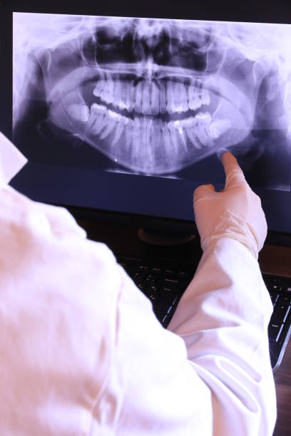 Best Emergency Dental Care for Broken or Chipped Teeth in Canton, SD